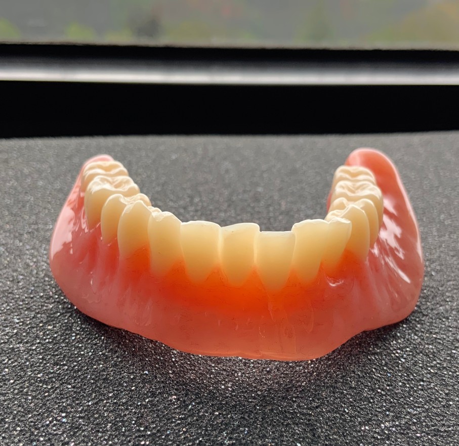 Lower Suction Dentures in Vancouver, BC