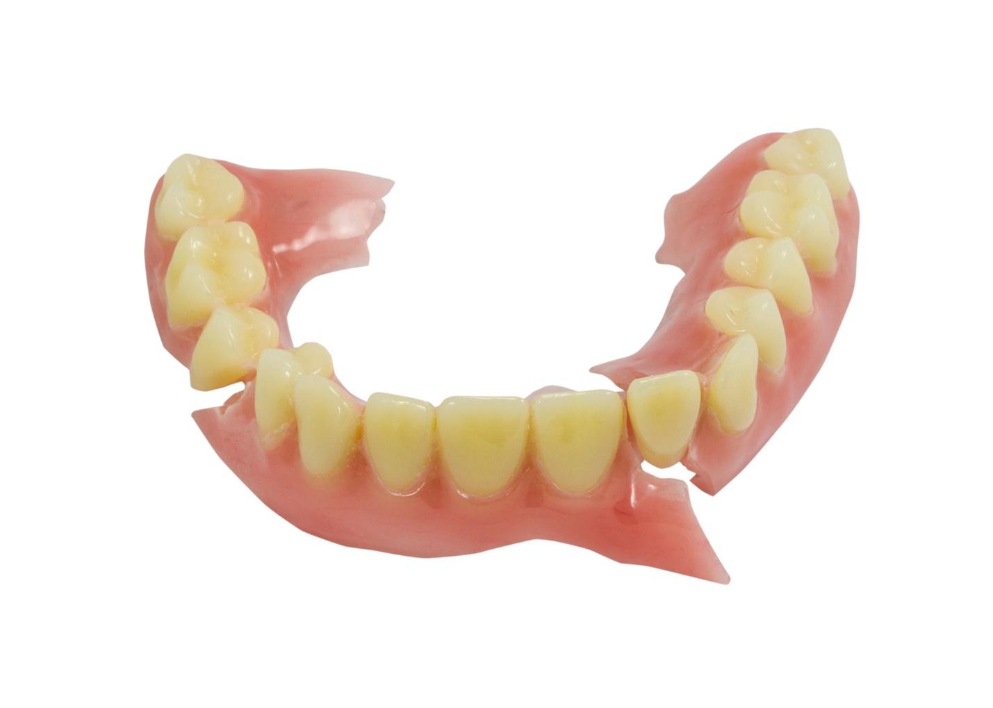 Dentures repair process